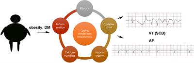 Clinical Overview of Obesity and Diabetes Mellitus as Risk Factors for Atrial Fibrillation and Sudden Cardiac Death